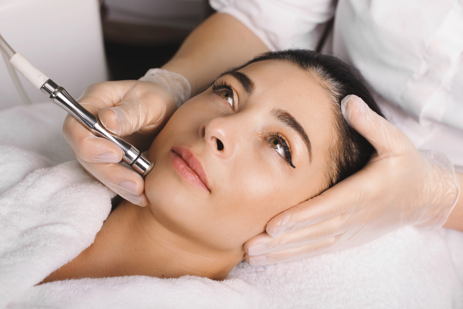hyperpigmentation treatments